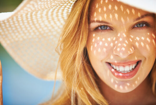invisalign