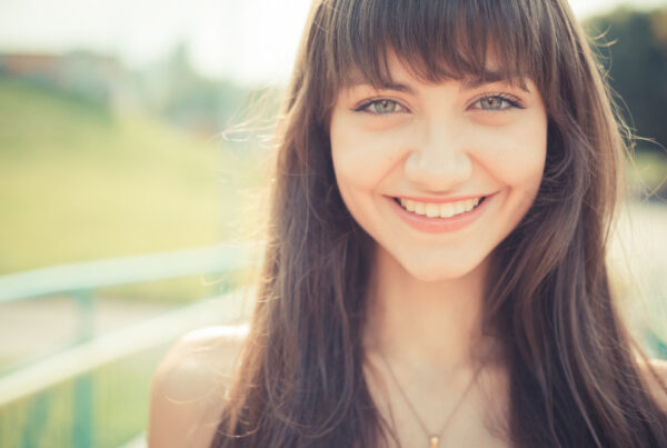 veneers