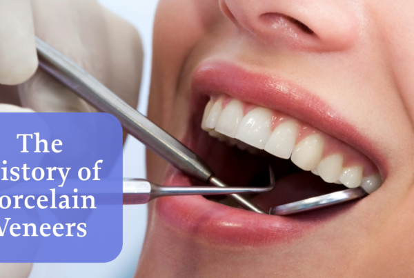 veneers