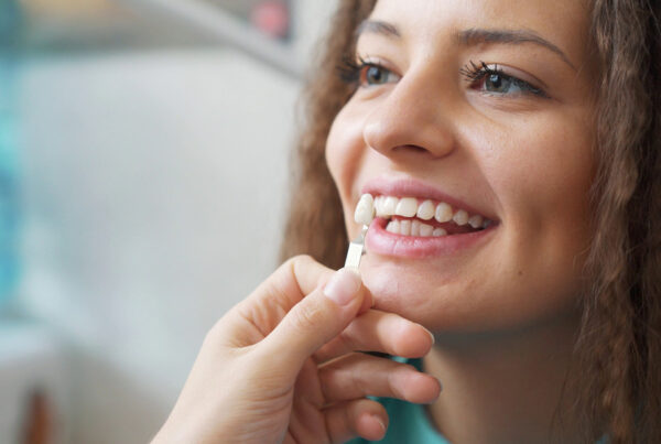 teeth whitening