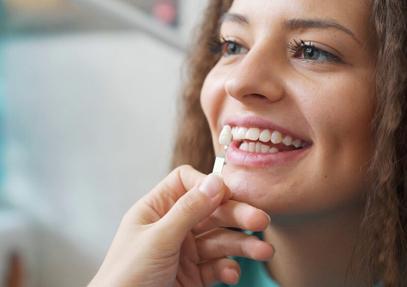 teeth whitening