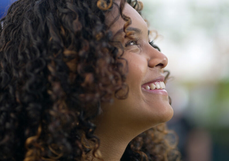 veneers