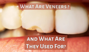 cosmetic dentistry