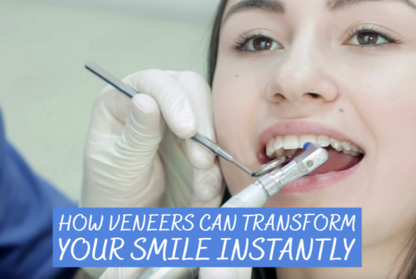 veneers