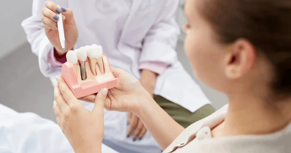 Dental Implants in Encino A Patient-Friendly Guide to Replacing Missing Teeth