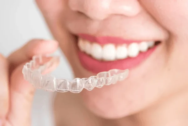 Invisalign in Encino: How Clear Aligners Help Straighten Teeth Discreetly