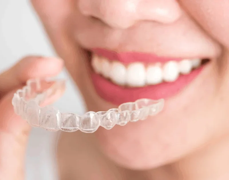 Invisalign in Encino: How Clear Aligners Help Straighten Teeth Discreetly