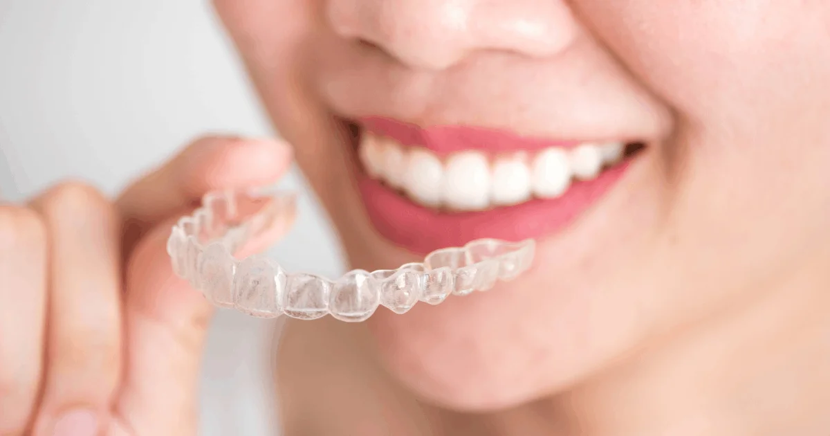 Invisalign in Encino: How Clear Aligners Help Straighten Teeth Discreetly