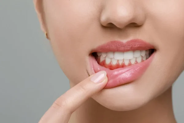 Gum Disease Signs You Should Not Ignore